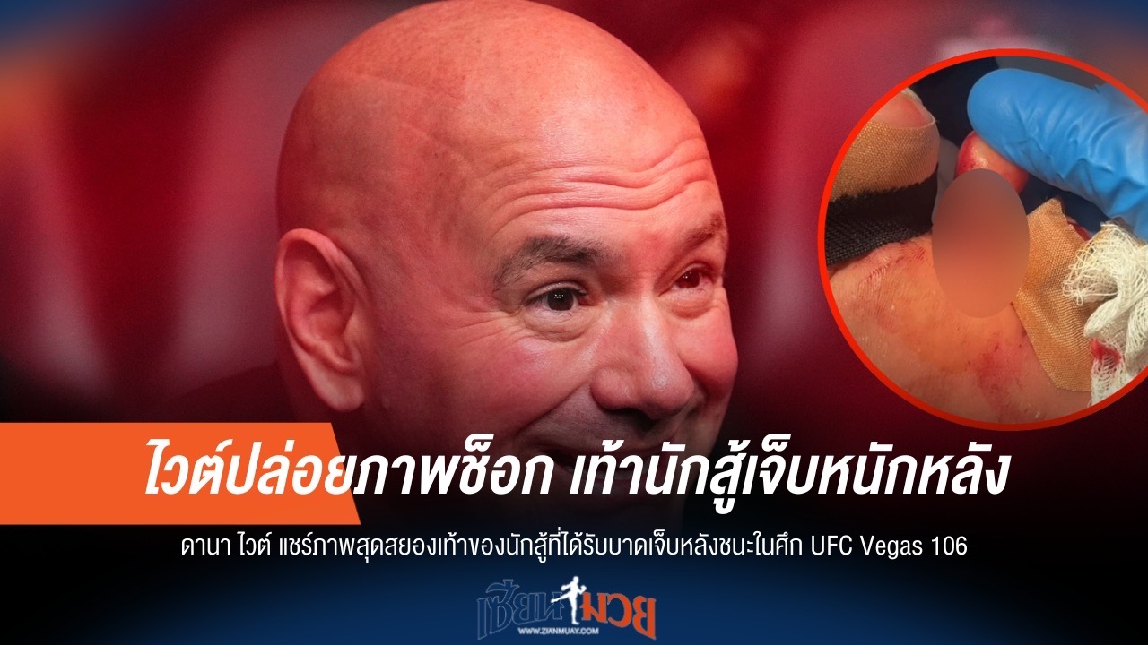 ไวต์ปล่อยภาพช็อก! เท้านักสู้เจ็บหนักหลังคว้าชัย UFC